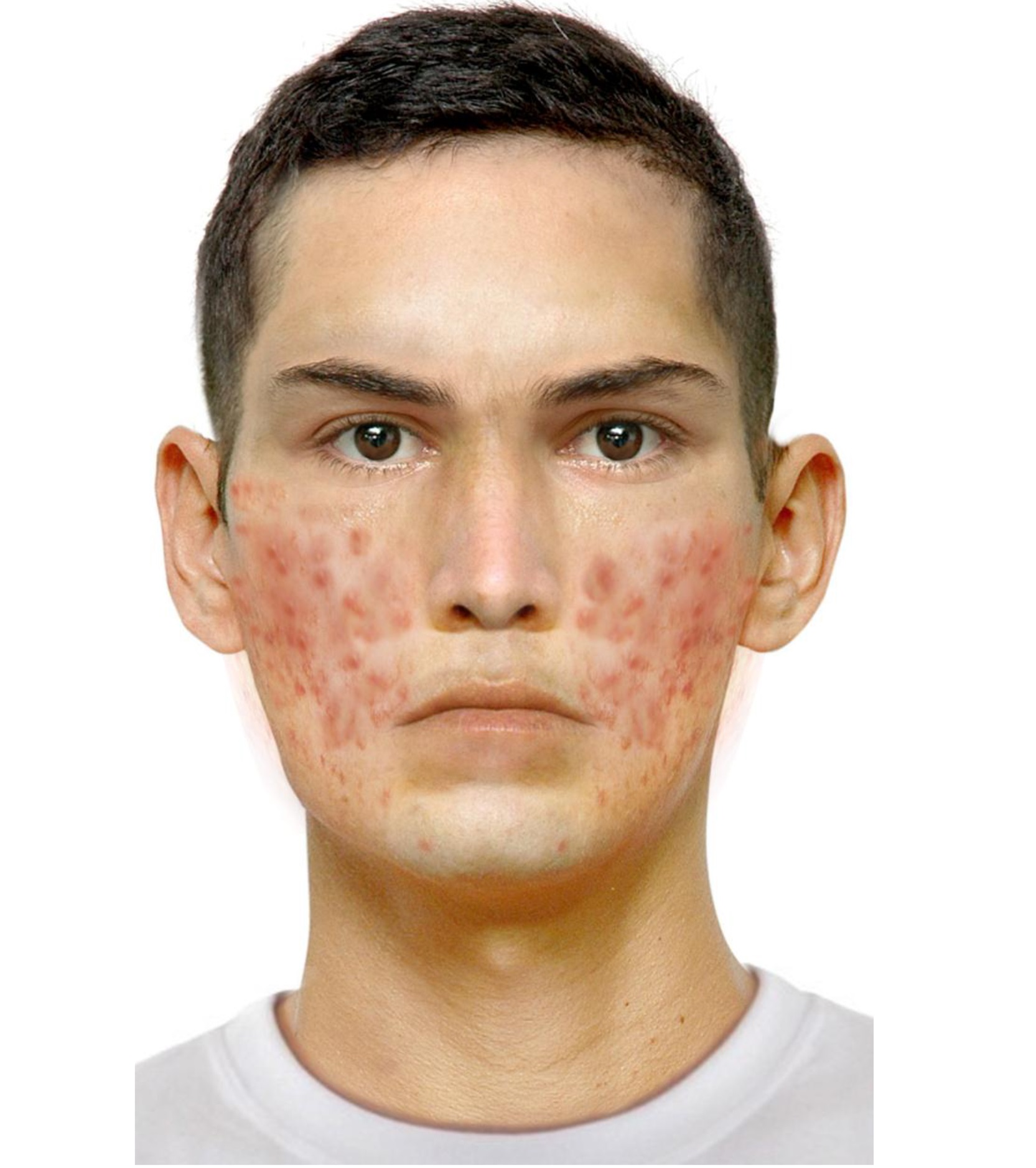 Foto do procurado
